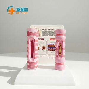 Modè<span class=keywords><strong>le</strong></span> anatomique de trachée humaine pour l'asthme <span class=keywords><strong>et</strong></span> les bronches, avec comparaisons normales <span class=keywords><strong>et</strong></span> pathologiques <span class=keywords><strong>et</strong></span> carte explicative (matériau PVC) - Product Image 1