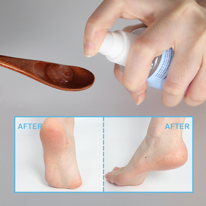 Spray et Crème pour les Pieds Adultes avec Vitamine C et Acide Hyaluronique, Extrait <span class=keywords><strong>de</strong></span> Noix <span class=keywords><strong>de</strong></span> Coco, Exfoliant, Blanchissant, Lissant pour les Pieds - Product Image 4