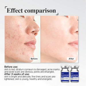 أحدث مجمع خلايا جذعية كوري نباتي وحيواني مجدد - Product Image 5