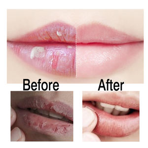 Nouveau mignon unique <span class=keywords><strong>baume</strong></span> à lèvres végétalien hydratant sans cruauté <span class=keywords><strong>baume</strong></span> à lèvres carré marque privée boule de <span class=keywords><strong>baume</strong></span> à lèvres - Product Image 3