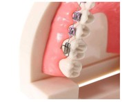 Modèle de dents anatomiques en PVC avec support en métal pour la démonstration d'orthodontie dentaire Modèle de traitement des sciences médicales-Dents humaines