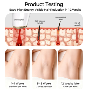Depiladora IPL indolora con enfriamiento por hielo, portátil, a batería, para uso doméstico, con sensor automático de tono de piel, para rostro y <span class=keywords><strong>cuerpo</strong></span>, para hombres - Product Image 4