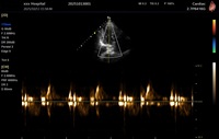 Échographe vétérinaire couleur Doppler 4D 15,6 pouces – Système d'échographie vétérinaire – Prix
