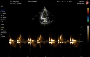 Échographe vétérinaire couleur Doppler 3D 15,6 pouces – Système d'échographie vétérinaire – Prix - Product Image 3