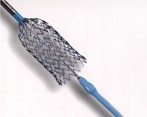 Rete in Nitinol Autodilatabile Intrecciata per <span class=keywords><strong>Stent</strong></span> Biliari nel Trattamento di Stenosi Maligne e Benigne - Product Image 4
