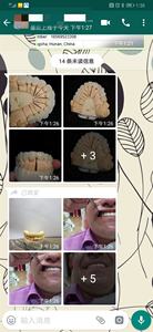 Vsmile 98-14mm Blocs de zircone dentaire pré-ombragés couleur ST, Matériaux pour fraiseuse CAD CAM, Disque brut certifié CE 1200Mpa - Product Image 5