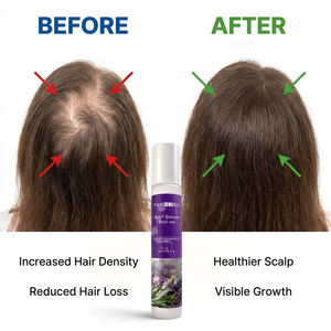 Suero Esencial para <span class=keywords><strong>el</strong></span> Tratamiento del Cuero Cabelludo con Lavanda y Manzanilla, <span class=keywords><strong>Aceite</strong></span> Natural Orgánico para <span class=keywords><strong>Cabello</strong></span> Seco, Dañado y Encrespado, Venta al Por Mayor - Product Image 2