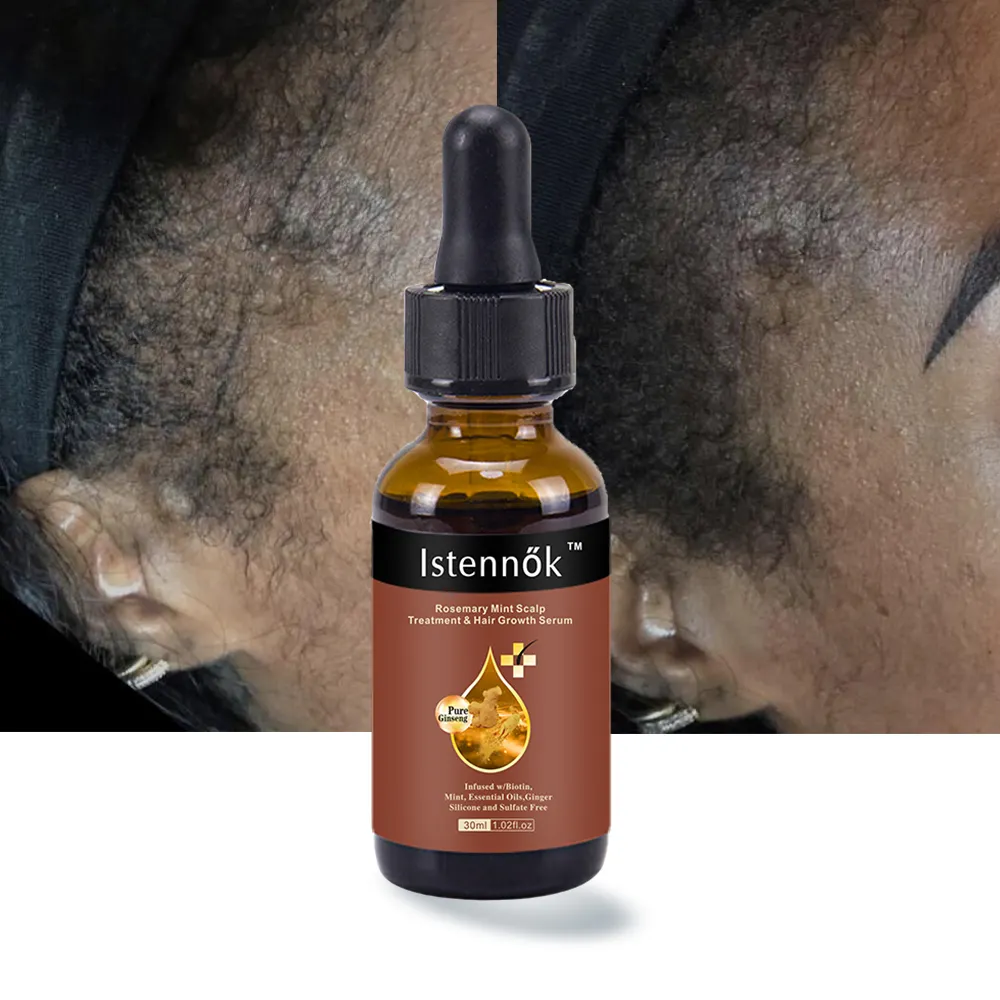 Óleo de cabelo orgânico de Rosemary do OEM ODM óleo de cabelo anti-perda de fortalecimento do cabelo