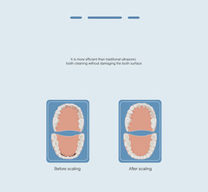 Laboratorio odontoiatrico clinica odontoiatrico in alluminio abrasione aria lucidatrice sabbiatrice ossido di alluminio Micro <span class=keywords><strong>Blaster</strong></span> con sistema di raffreddamento - Product Image 5