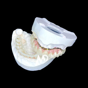 Premium Implantaat-Ondersteunde Prothese | Titanium <span class=keywords><strong>Abutment</strong></span> Met Precisie Zirkonia Kroon Voor Stabiele En Comfortabele Pasvorm - Product Image 4