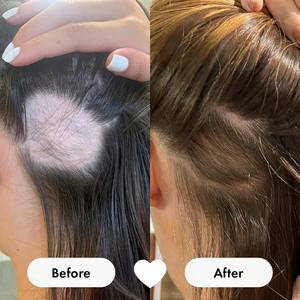 Haar, huid & nagels <span class=keywords><strong>gummy</strong></span> snoep voor volwassenen met biotine 10.000 mcg, suikervrij, vegan, 60 <span class=keywords><strong>gummy</strong></span> snoepjes, rechtstreeks van de fabriek - Product Image 5