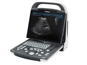 Escáner de Ultrasonido Portátil Digital en Blanco y Negro Mindray DP-20, Ultrasonido Obstétrico para Animales y Humanos Veterinarios con Sonda Convexa - Product Image 2