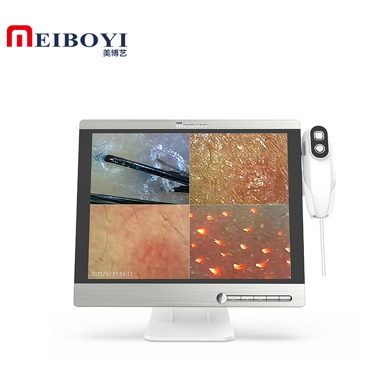 Meiboyi 15,5 дюймов HD дисплей с 2 линзами перхоти кожи головы поврежденная машина для анализа волос камера для кожи головы 32 ГБ ОЗУ для домашнего использования