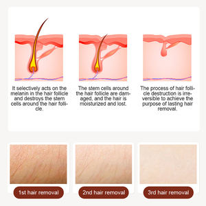 핫 세일 808 나노미터 다이오드 레이저 제모기 3파장 레이저 뷰티 장비 영구 제모 레이저 제모 - Product Image 3