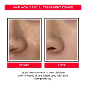 Fábrica amazo n fornecedor elétrica face lift reforço radiância eletroporação sem agulha 4 em 1 máquina de aperto da pele facial