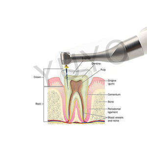 Impianto dentale impianto elettrico chiave impianto motore torsione Driver odontoiatria endodontico Dono motore con apice - Product Image 4