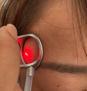 Tubo de Vidrio Portátil para Máquina de Láser <span class=keywords><strong>CO2</strong></span> <span class=keywords><strong>Fraccional</strong></span> con Función de Lifting Facial y Uso Comercial - Product Image 2