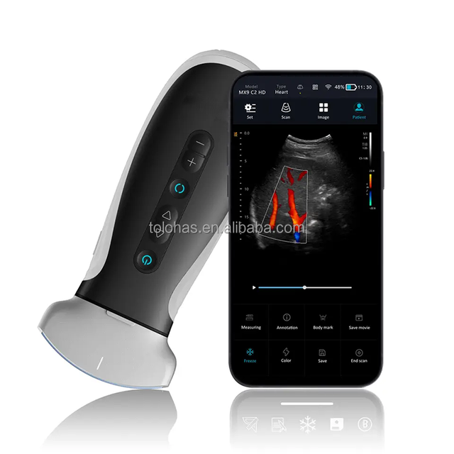 LHWMX9 Smart WIFI Vet Ultrasound Scanner Portable Wireless Probe Pocket Ultrasound Machine