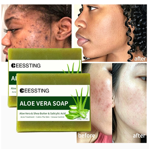 Jabón en Barra de Aloe Vera para Baño, Blanqueador de Piel Hecho a Mano, Hidratante Suave, Facial, Iluminador, Suavizante y Limpiador Profundo - Product Image 1