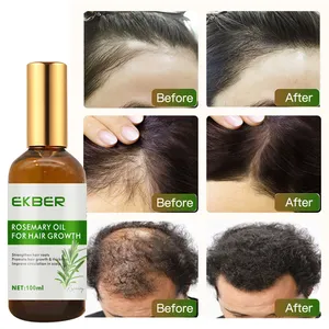 Low Moq Rosemary Oil For Hair Growth Anti Frizz Moroccan Hair Oil Curly Hair Products