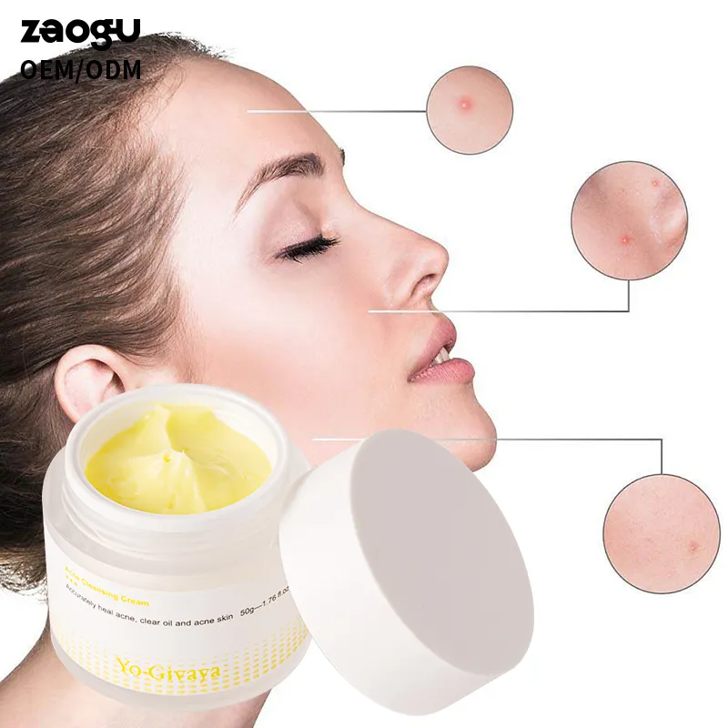 Crème de traitement anti-acné transparente multi-actions de marque privée crème éclaircissante pour adultes crème éclaircissante pour la peau crème au citron