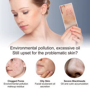 Tẩy da chết làm giảm đỏ da <span class=keywords><strong>BHA</strong></span> <span class=keywords><strong>2</strong></span>% axit salicylic cho mụn đầu đen & mở poresface huyết thanh loại bỏ mụn đầu đen huyết thanh - Product Image 3