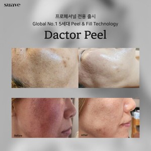 Ampolla Exfoliante Facial Dactor Peel Korea Homecare con Ácido Láctico, Niacinamida y <span class=keywords><strong>Bacterias</strong></span> Lácticas, Sérum Antienvejecimiento para el Cuidado de <span class=keywords><strong>la</strong></span> <span class=keywords><strong>Piel</strong></span> - Product Image 6