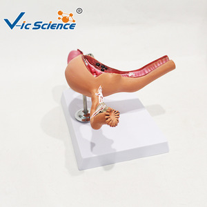 Modelo patológico uterino femenino humano; modelo de demostración para enseñanza y formación médica ginecológica; material didáctico de anatomía. - Product Image 4