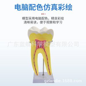 Modelo de diente humano ampliado 12 veces con molde desmontable para la anatomía del diente, pulpa, nervio, incisivos, caninos y molares. - Product Image 5