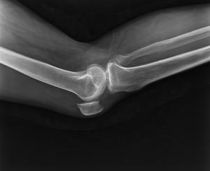 Détecteur à écran plat numérique DR FPD X-ray Imaging 14X17 - Product Image 4