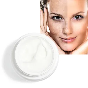 New Design Face Cream Mother Care Products OMY LADY Freckle Remover Face Anti Spot Whitening Cream