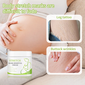 プライベートブランド ハーブ産後ストレッチマーク除去クリーム しわ対策 肌修復 傷跡除去 妊娠線クリーム 全身用 - Product Image 5
