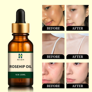 Óleo de Semente de Rosa Mosqueta 100% Puro Natural Orgânico Óleo Carreador de Sândalo e Bergamota Prensado a Frio para Revitalização da Pele do Rosto para Todos os Tipos de Pele - Product Image 2