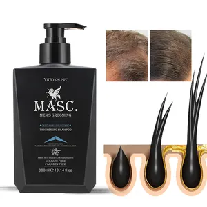 Биотин для роста волос, шампунь против выпадения волос, имбирный сульфат, Бесплатная оптовая продажа, шампунь против выпадения волос