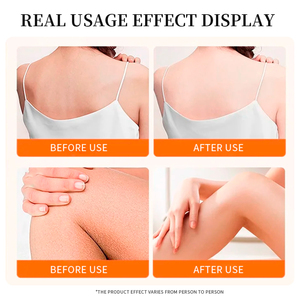 Crema Exfoliante Blanqueadora con Vitamina C y <span class=keywords><strong>Aloe</strong></span> Vera de WMB, Fórmula Segura para Limpieza Facial e Hidratación de la Piel, OEM - Product Image 5
