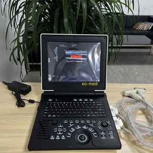 Échographe Doppler Couleur Portable pour Hôpital, Meilleur Prix, Appareil d'Échographie Humaine Portable CU20 - Product Image 5