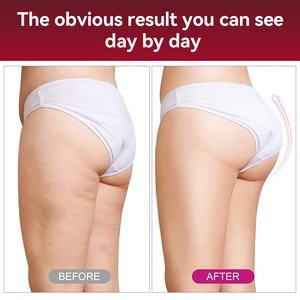 Chinaherbs Bio Beauté Fesses Hanche Booster Bonbons Gommeux Vitamines De Marque Privée Adulte Hanche Élargissement Fesses Supplément De Levage - Product Image 6