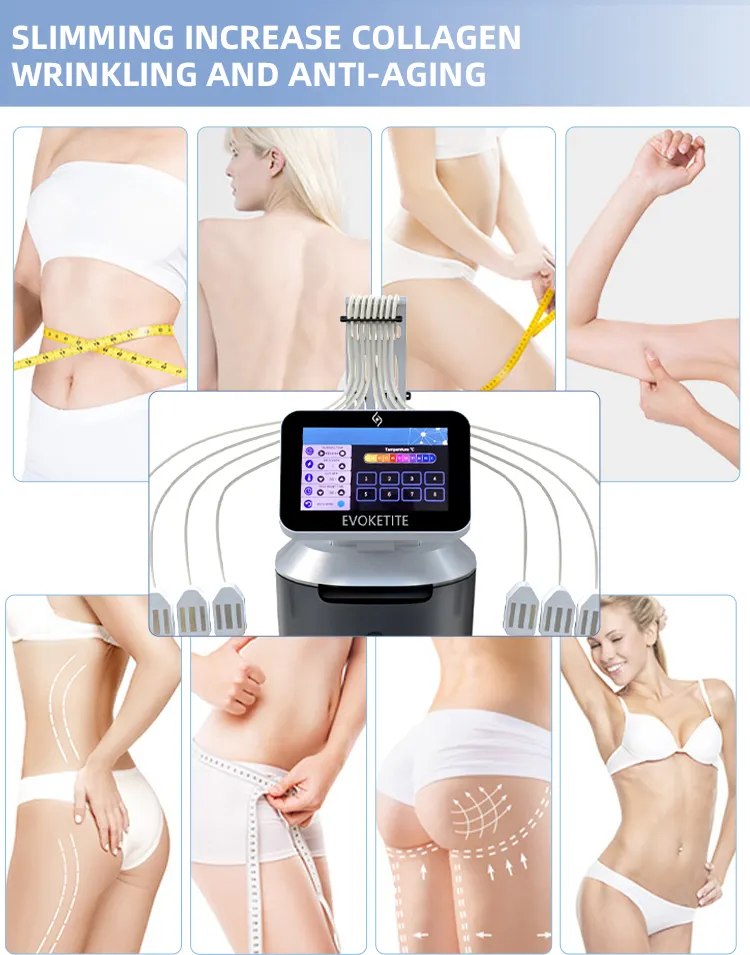 Trusculpt 3d id 2Mhz rf skin tightening evolve tite body sculpting inmode tite rf trusculpt id flex machine