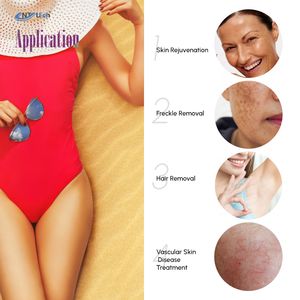 755nm lungo impulso dolce alessandrite nd yag laser di epilazione candela produttore prezzo - Product Image 2