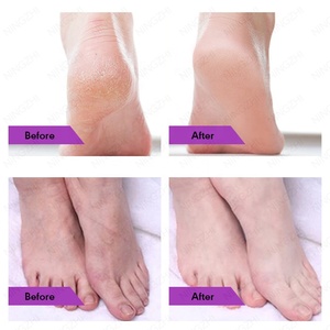Polvo para Pedicura NingZhi <span class=keywords><strong>Jelly</strong></span>, Cuidado Calmante para la Piel de los Pies, Exfoliante de Sal Marina, Alivia el Cansancio de los Pies - Product Image 6