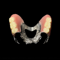Prothèse partielle en alliage de cobalt-chrome de haute précision pour les laboratoires et cliniques dentaires |   Prothèse métallique amovible personnalisée CAD/CAM 2026