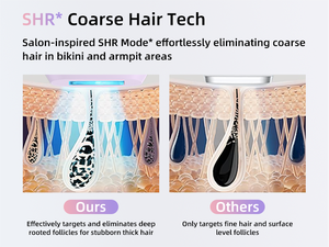 Appareil d'<span class=keywords><strong>épilation</strong></span> permanente à domicile, <span class=keywords><strong>épilation</strong></span> au laser IPL avec refroidissement par glace saphir - Indolore et rapide pour femmes et hommes - Product Image 5