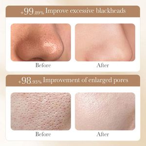 BIOAQUA <span class=keywords><strong>precio</strong></span> al por mayor arroz coreano Peel Off máscara removedor de espinillas Limpieza de poros reducción blanqueamiento cuidado de la piel máscara facial - Product Image 4
