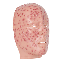Máscara de silicona de maniquí para entrenamiento médico: modelo de exhibición facial de viruela severa