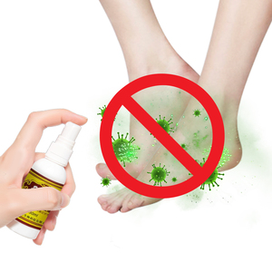 तियन लूओ शान लोकप्रिय उत्पाद दर्द और खुजली राहत प्राकृतिक हर्बल एंटीबैक्टीरियल डिओडोनाइजिंग पैर देखभाल स्प्रे - Product Image 2