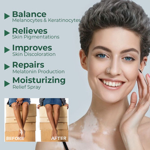 Traitement du vitiligo <span class=keywords><strong>Psoriasis</strong></span> antibactérien pommade localisée tache blanche leucoplasie plâtre - Product Image 3