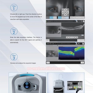 เครื่อง OCT อัตโนมัติเต็มรูปแบบสำหรับจักษุวิทยา ราคาประหยัด รุ่น OCT-50 - Product Image 5