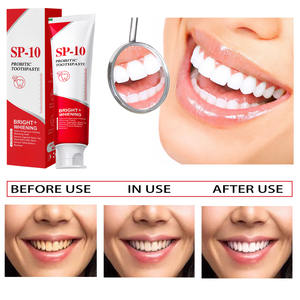 Pasta Dental Probiótica SP-10 para el Cuidado Bucal, Blanqueadora, Elimina Manchas de Té y Café, Aliento Fresco a Menta, 120g - Product Image 4