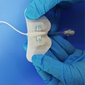 Bán Hot picc CVC ống thông dòng ổn định thiết bị ống thông securement thiết bị 3x9cm ống thông chủ sửa chữa thiết bị - Product Image 5