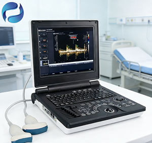 Máquina de Ultrasonido Doppler a Color 3D/4D/<span class=keywords><strong>5D</strong></span> Portátil con IA Avanzada, Construcción Metálica, Fuente de Alimentación Eléctrica - Product Image 4